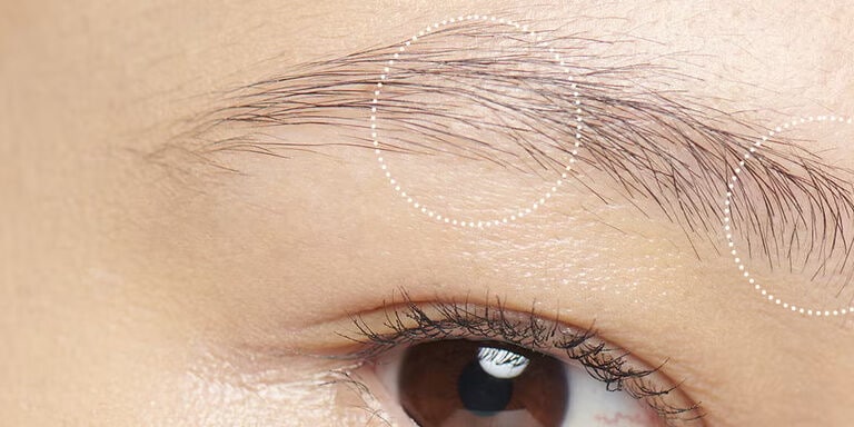 sourcils clairsemés
