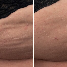 The Body Cream - Crème hydratante pour le corps