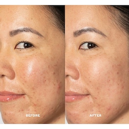 Glow 2OH Dark Spot Toner - Lotion Tonique Visage anti-taches aux AHA 
