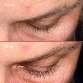 Lashbond™ - Sérum Pour Les Cils