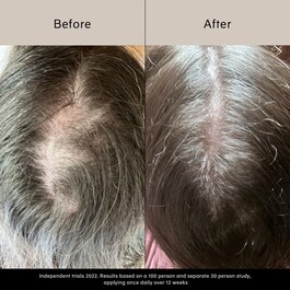 Pitta Growth Serum - Sérum de croissance pour cheveux