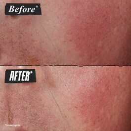 Ultra Facial Advanced Repair Barrier Cream - Crème Réparatrice Et Apaisante