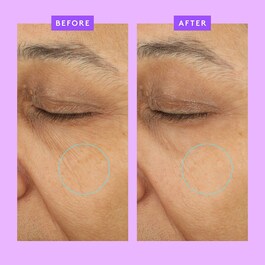 Ceramighty™ AF - Baume pour le Contour Des Yeux