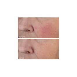 Vitamin C + Lactic - Soin Hydratant Intense Fermeté Lift