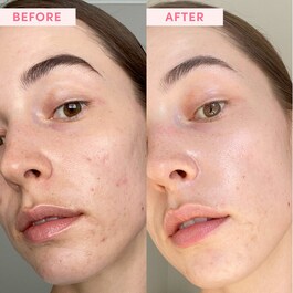 Australian Pink Clay - Masque Réducteur de Pores