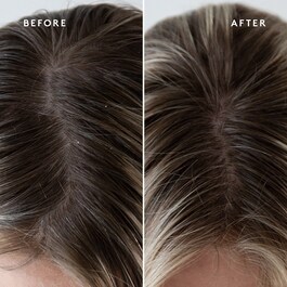 Topical Scalp Supplement - Sérum Cuir Chevelu