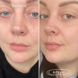 Rosehip Bioregenerate - Huile Visage Universelle au Rosier Sauvage