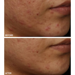 FaceWare Pro - Masque Visage LED