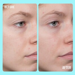 10% Vitamin C Brightening Serum - Sérum Illuminateur avec 10% de Vitamine C 