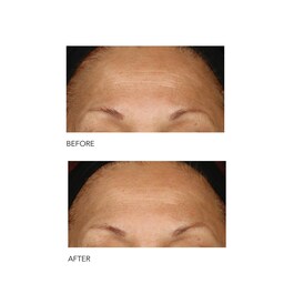 Alpha Beta® - Peeling Quotidien Formule Intense