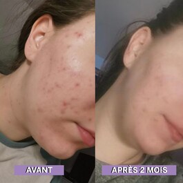 Skin Cleaner Gélules - Complément alimentaire Peau