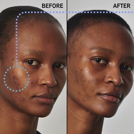 Solution contre l'excès de sébum avec du niacinamide 20 % - Sérum visage