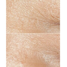 Smart Clinical Repair™ - Crème Correctrice Anti-rides