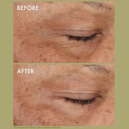 Plantscription™ - Crème Yeux Correction Rides au Rétinol Encapsulé