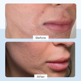 Ultra Repair Cream - Crème hydratation intense visage et corps