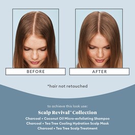 Scalp Revival Charcoal - Traitement pour le Cuir Chevelu