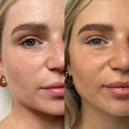 The Face - Gouttes auto-bronzantes