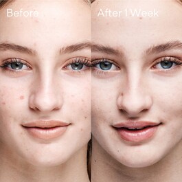 Contrôle des Imperfections - Soin clarifiant anti-imperfections Outsmart