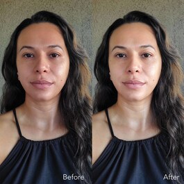 UFO ™ - Infuseur de Soin Visage puissant