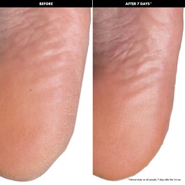 Masques Pieds Peeling - Masques exfoliants pieds
