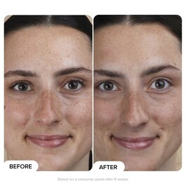 C5 Super Boost Moisturiser - Crème Hydratante C5 Super Boost