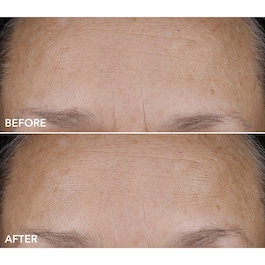 DermInfusions™ - Soin Hydratant Lissant + Réparateur