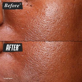 Sérum Ultra Pur - Sérum Visage à la Niacinamide