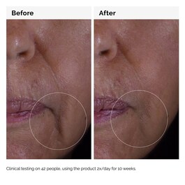 Solution GF 15% - Sérum anti-âge