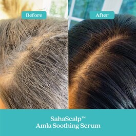 SahaScalp™ - Sérum Apaisant à l'Amla