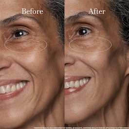 Black Tea Age Renewal Eye Concentrate – Crème des yeux anti-âge au thé noir