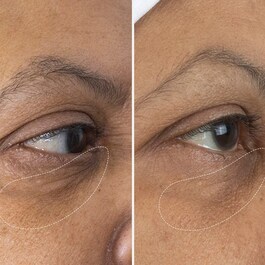 The Eye Cream - La Crème pour les yeux