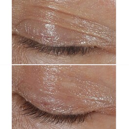Smart Clinical Repair™ - Crème Yeux Correction Rides
