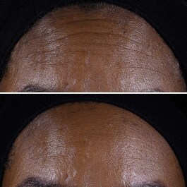 Smart Clinical Repair™ - Crème Liftante Visage + Cou