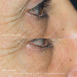 Awaken Peptide Eye Gel - Gel contour des yeux