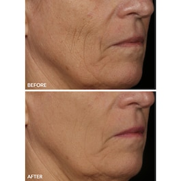 FaceWare Pro - Masque Visage LED