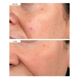 Dark Spot Correcting Serum - Sérum Correcteur De Taches Sombres