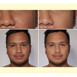 Yo Glow - Gommage Visage 3-en-1 - Format Voyage