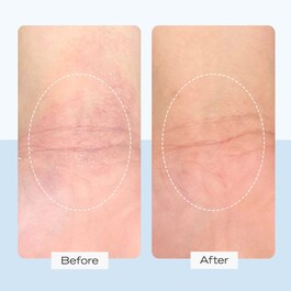 Ultra Repair Cream - Crème hydratation intense visage et corps
