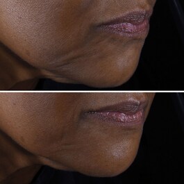 Smart Clinical Repair™ - Crème Liftante Visage + Cou
