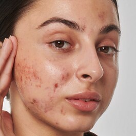 Solution contre les cicatrices, marques & rides rétinol 1 % - Sérum visage
