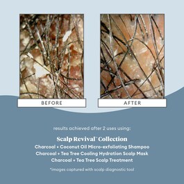 Scalp Revival Charcoal - Shampooing Exfoliant