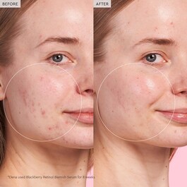 Blackberry Retinol - Sérum de réinitialisation