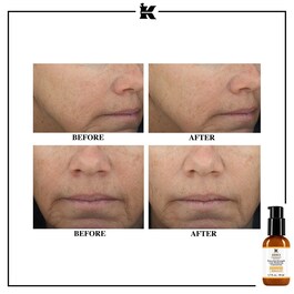 Sérum Anti-Rides à la Vitamine C - Powerful-Strength Line-Reducing Concentrate