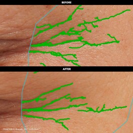 Lift & Firm - Crème Yeux Lissante Et Raffermissante