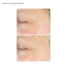 Vitamin C Lactic - Soin Contour des Yeux Eclat