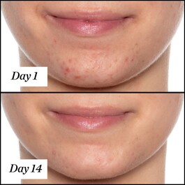 U.F.O. - Huile visage anti-imperfections