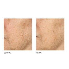 Alpha Beta® - Peeling Quotidien Formule Universelle