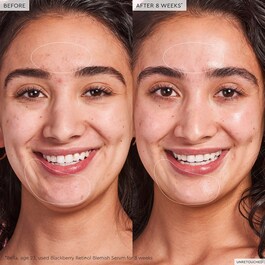 Blackberry Retinol - Sérum de réinitialisation