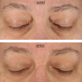 FAB Skin Lab Retinol & Hyaluronic Acid Eye Cream - Crème au Rétinol