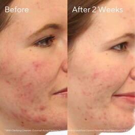 Contrôle des Imperfections - Gel nettoyant purifiant visage